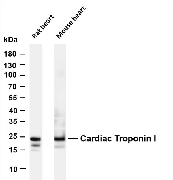 Various whole cell lysates were separated by 4-20% SDS-PAGE, and the membrane was blotted with anti-Cardiac Troponin I (PT0315R) antibody. The HRP-conjugated Goat anti-Rabbit IgG(H + L) antibody was used to detect the antibody.