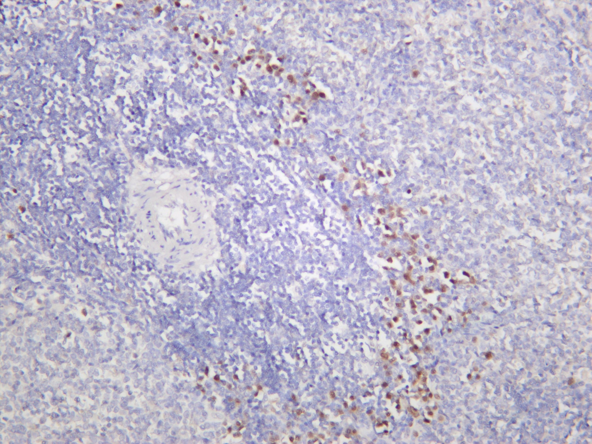 Rat spleen was stained with anti-XBP1 (PT0319R) rabbit antibody