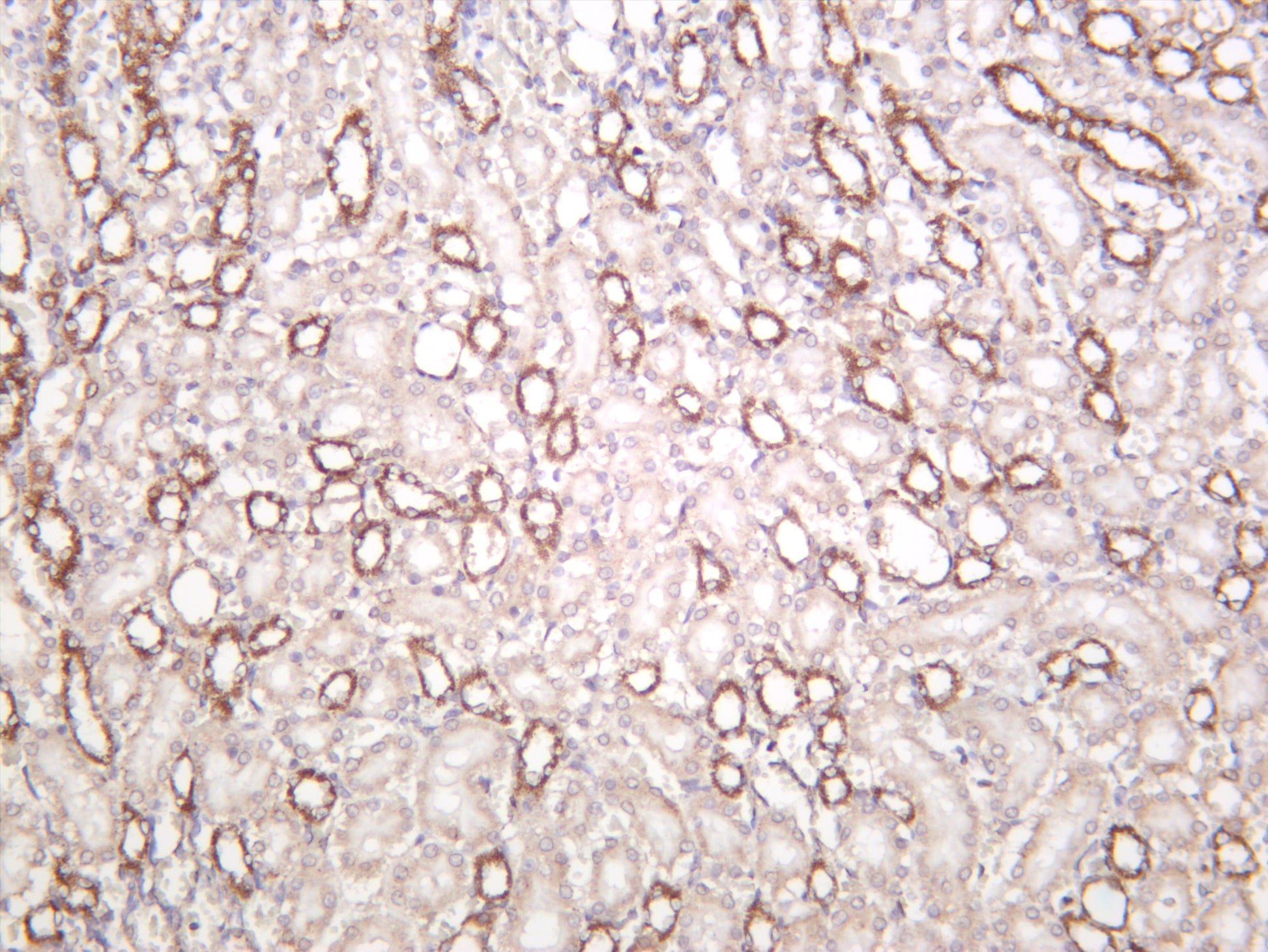 Rat kidney was stained with anti-Pyruvate Dehydrogenase E1 Î± (PT0322R) rabbit antibody