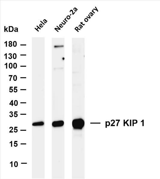 Various whole cell lysates were separated by 4-20% SDS-PAGE, and the membrane was blotted with anti-p27 KIP 1 (PT0324R) antibody. The HRP-conjugated Goat anti-Rabbit IgG(H + L) antibody was used to detect the antibody.