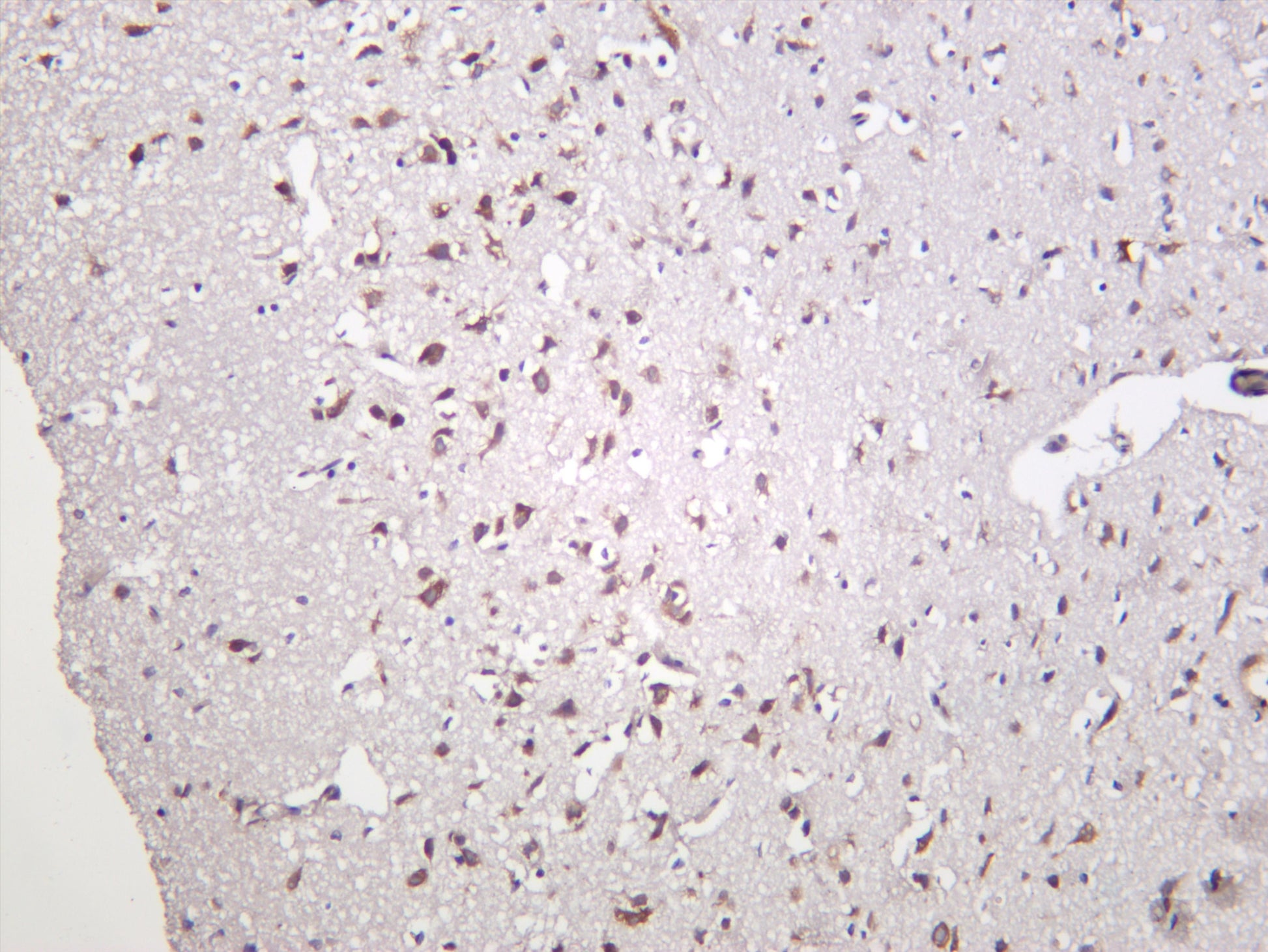 Rat brain was stained with anti-YTHDF1 (PT0326R) rabbit antibody