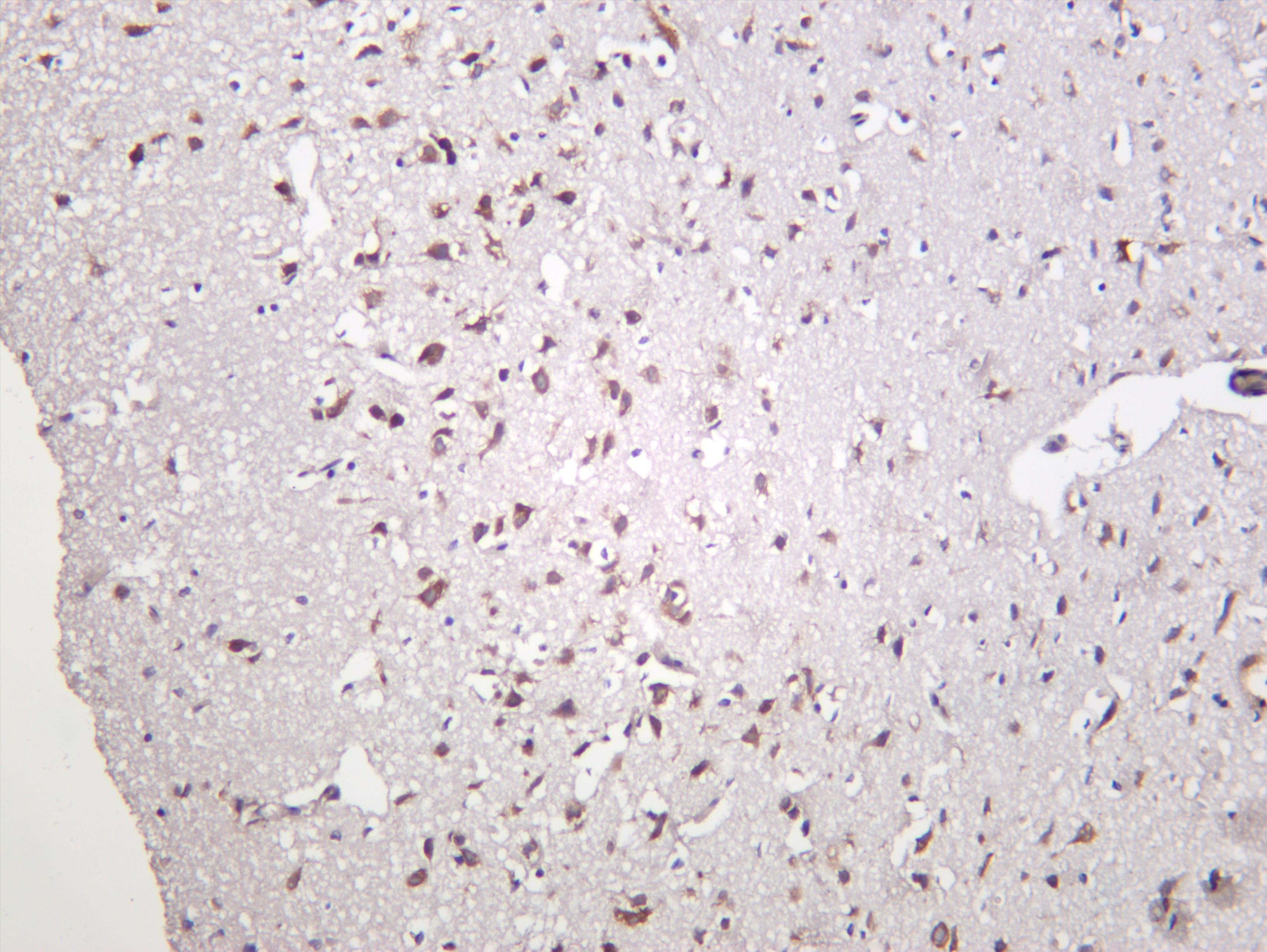 Rat brain was stained with anti-YTHDF1 (PT0326R) rabbit antibody