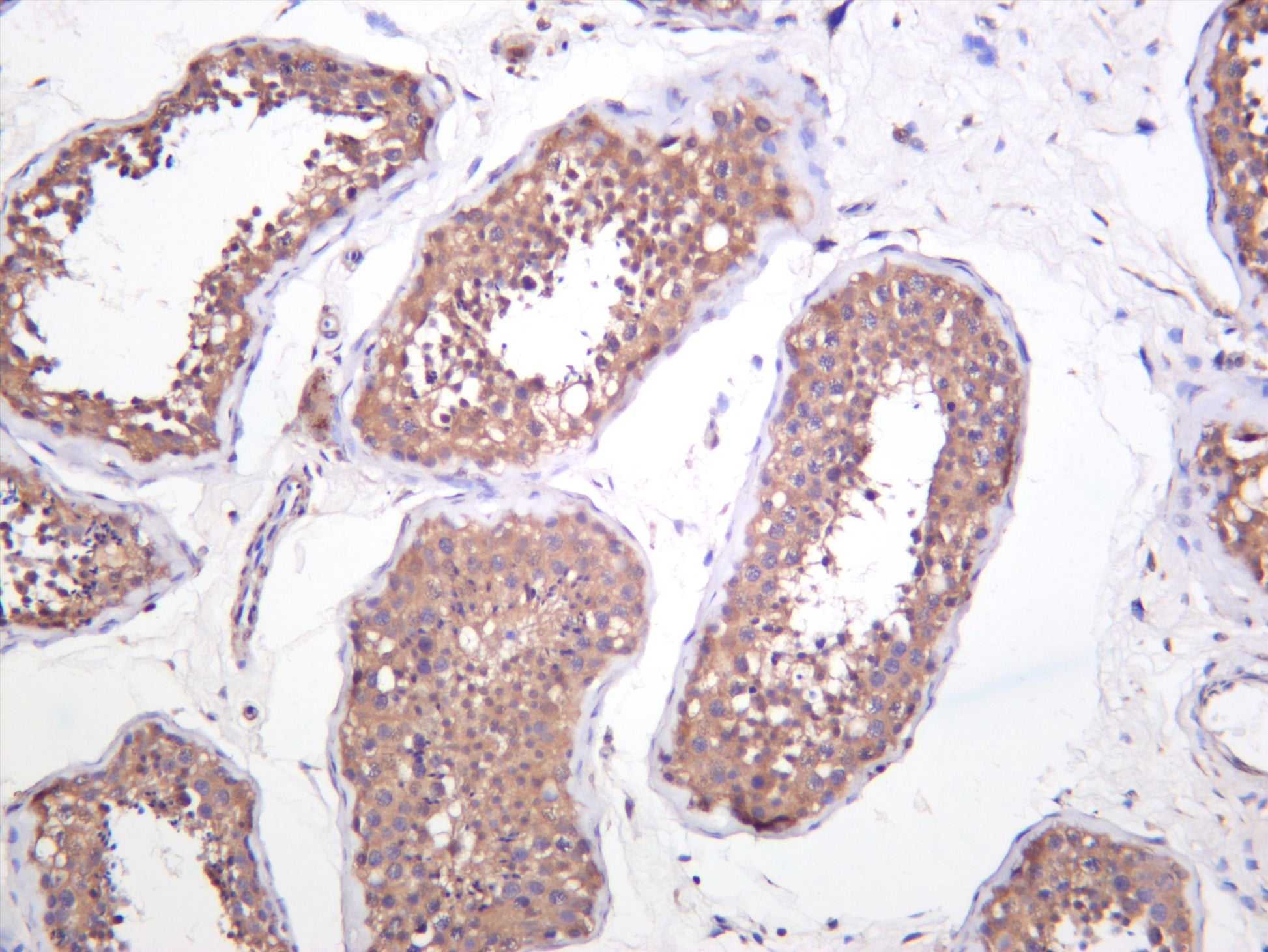 Human testis was stained with anti-Raf-B (phospho Thr401) (PT0329R) rabbit antibody