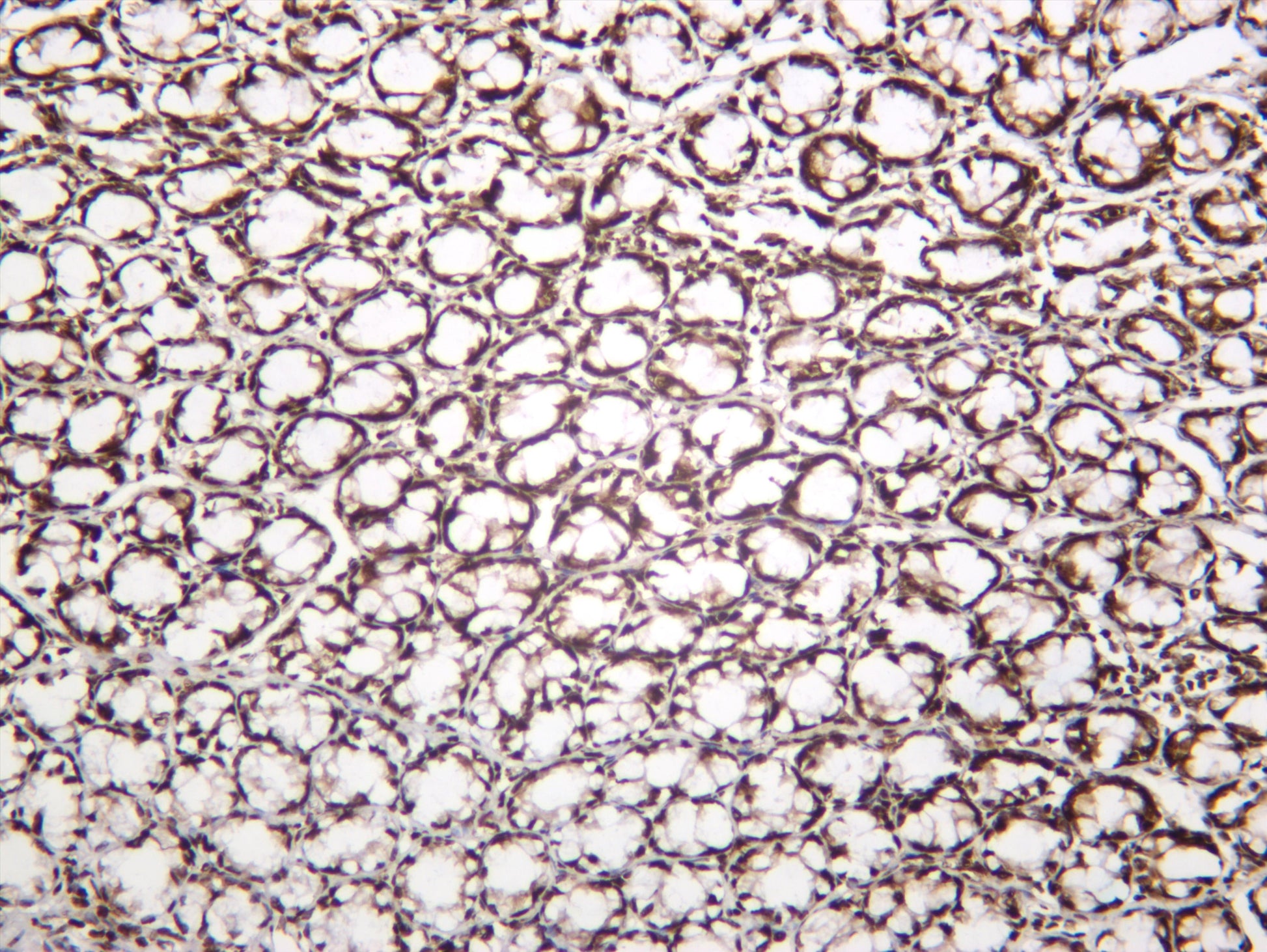 Rat colon was stained with anti-Histone H2A.X (phospho Ser139) (PT0330R) rabbit antibody
