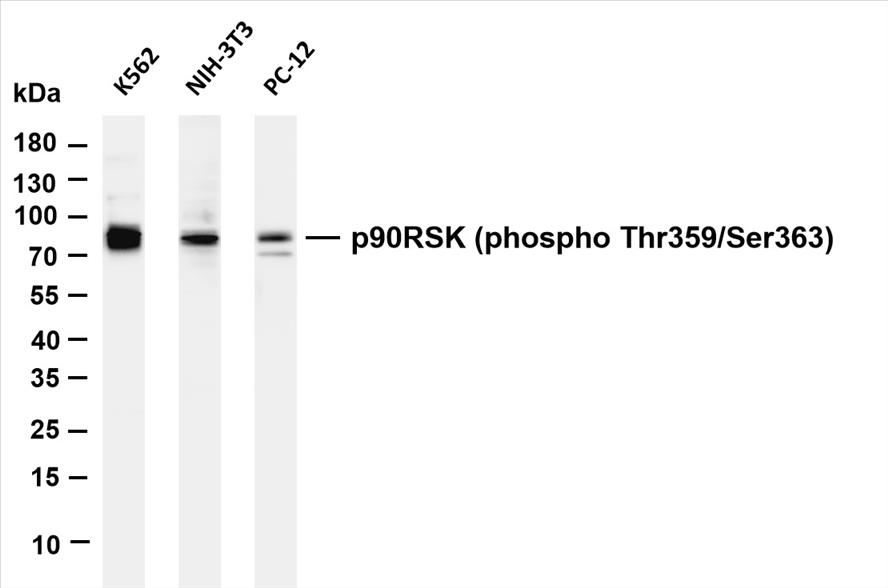 Various whole cell lysates were separated by 4-20% SDS-PAGE, and the membrane was blotted with anti-p90RSK (phospho Thr359/Ser363) (PT0067R) antibody. The HRP-conjugated Goat anti-Rabbit IgG(H + L) antibody was used to detect the antibody.