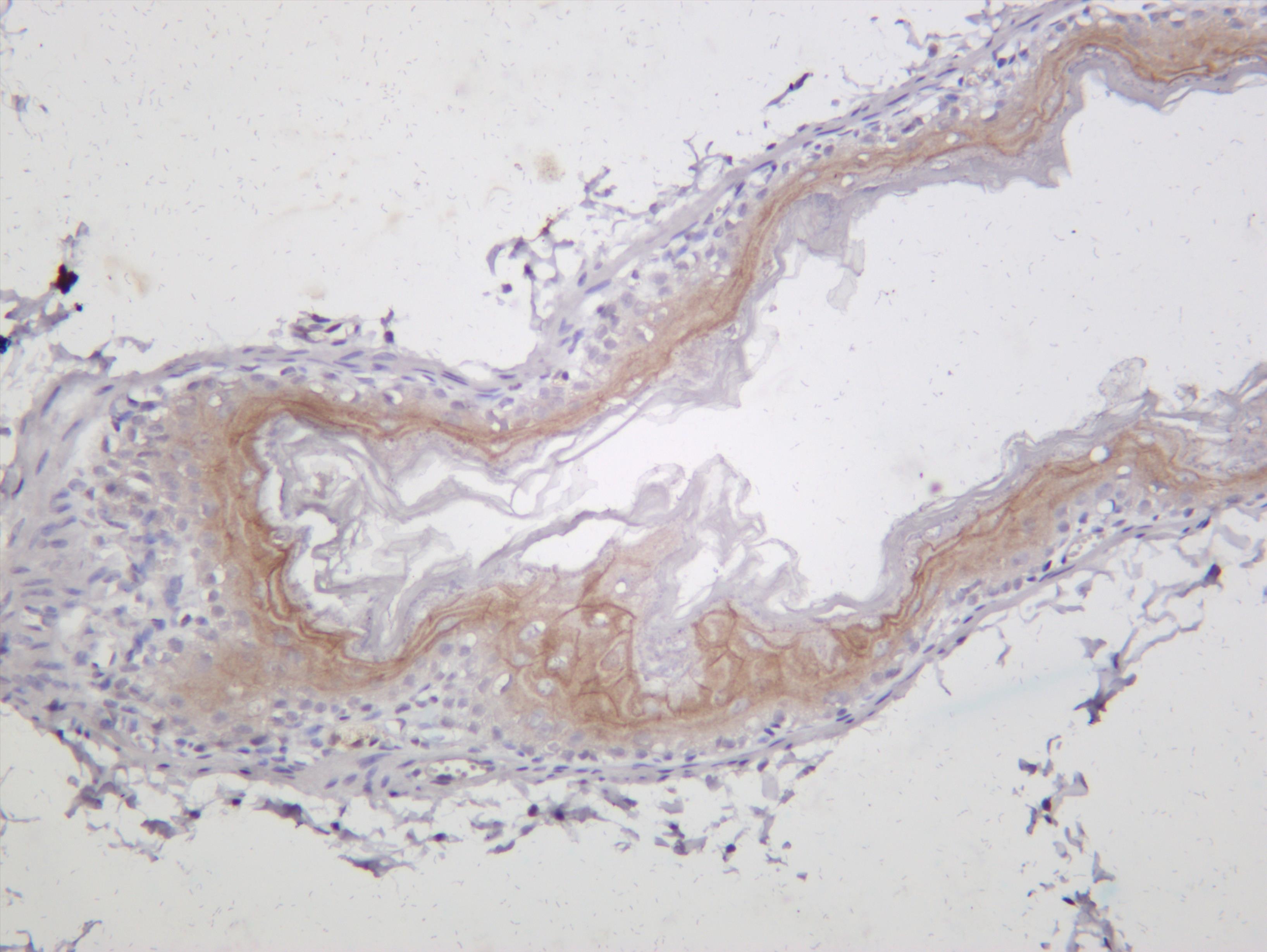 Mouse stomach was stained with anti-Claudin 1 (PT0336R) rabbit antibody