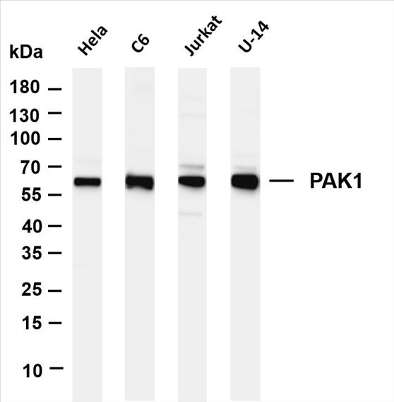 Various whole cell lysates were separated by 4-20% SDS-PAGE, and the membrane was blotted with anti-PAK1 (PT0342R) antibody. The HRP-conjugated Goat anti-Rabbit IgG(H + L) antibody was used to detect the antibody.