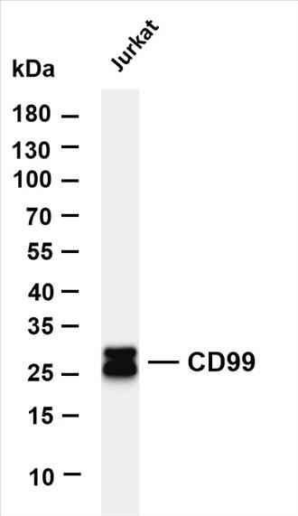 Various whole cell lysates were separated by 4-20% SDS-PAGE, and the membrane was blotted with anti-CD99 (PT0343R) antibody. The HRP-conjugated Goat anti-Rabbit IgG(H + L) antibody was used to detect the antibody.