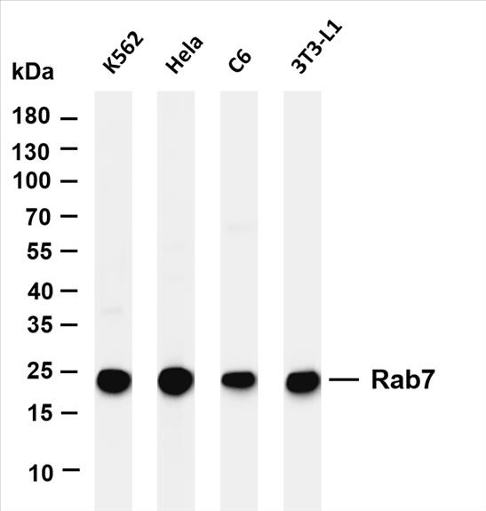 Various whole cell lysates were separated by 4-20% SDS-PAGE, and the membrane was blotted with anti-Rab7 (PT0345R) antibody. The HRP-conjugated Goat anti-Rabbit IgG(H + L) antibody was used to detect the antibody.