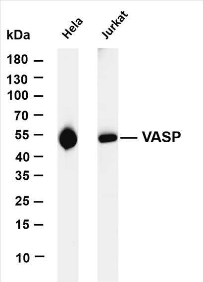 Various whole cell lysates were separated by 4-20% SDS-PAGE, and the membrane was blotted with anti-VASP (PT0347R) antibody. The HRP-conjugated Goat anti-Rabbit IgG(H + L) antibody was used to detect the antibody.