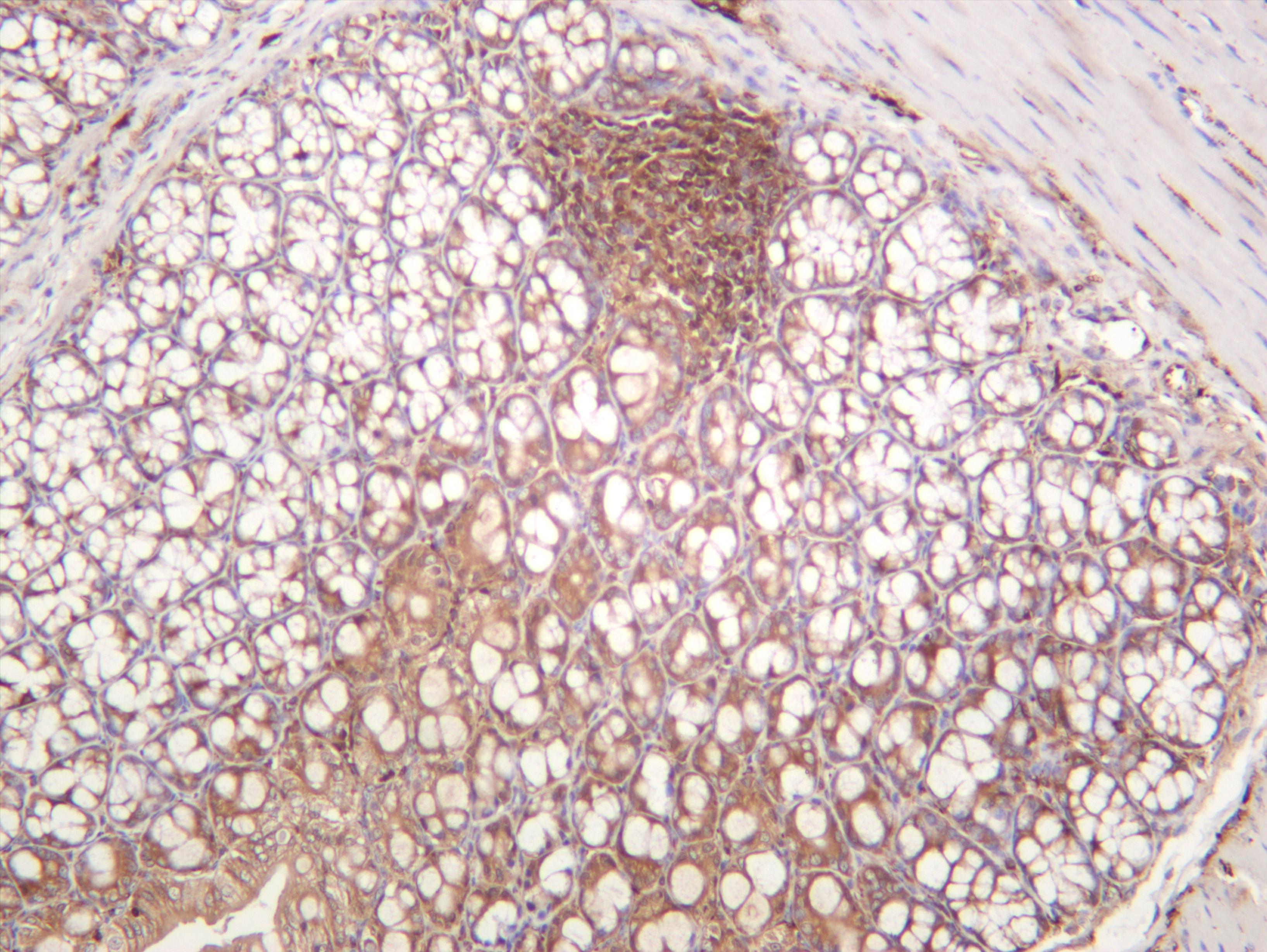 Mouse colon was stained with anti-NF-ÎºB p65 (PT0352R) rabbit antibody