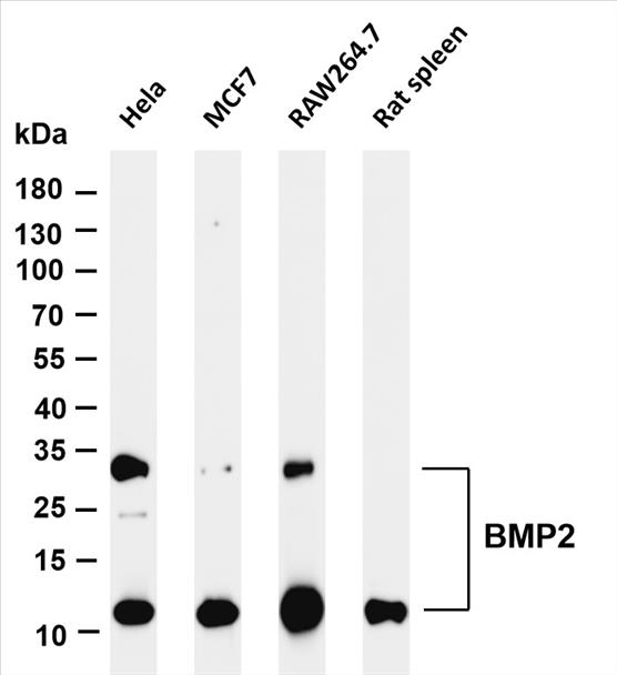 Various whole cell lysates were separated by 4-20% SDS-PAGE, and the membrane was blotted with anti-BMP2 (PT0362R) antibody. The HRP-conjugated Goat anti-Rabbit IgG(H + L) antibody was used to detect the antibody.