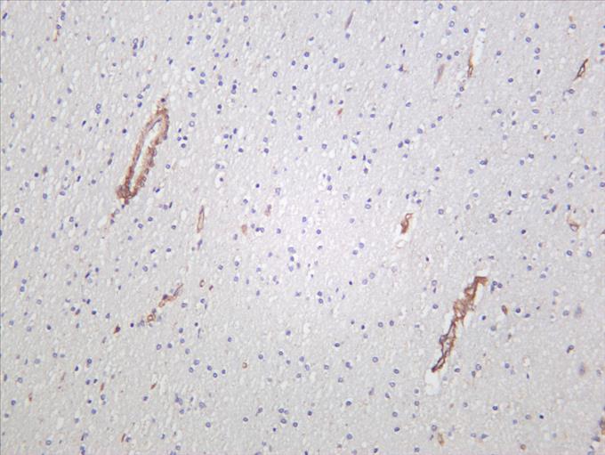 Human brain was stained with anti-IRE1Î± (PT0365R) rabbit antibody
