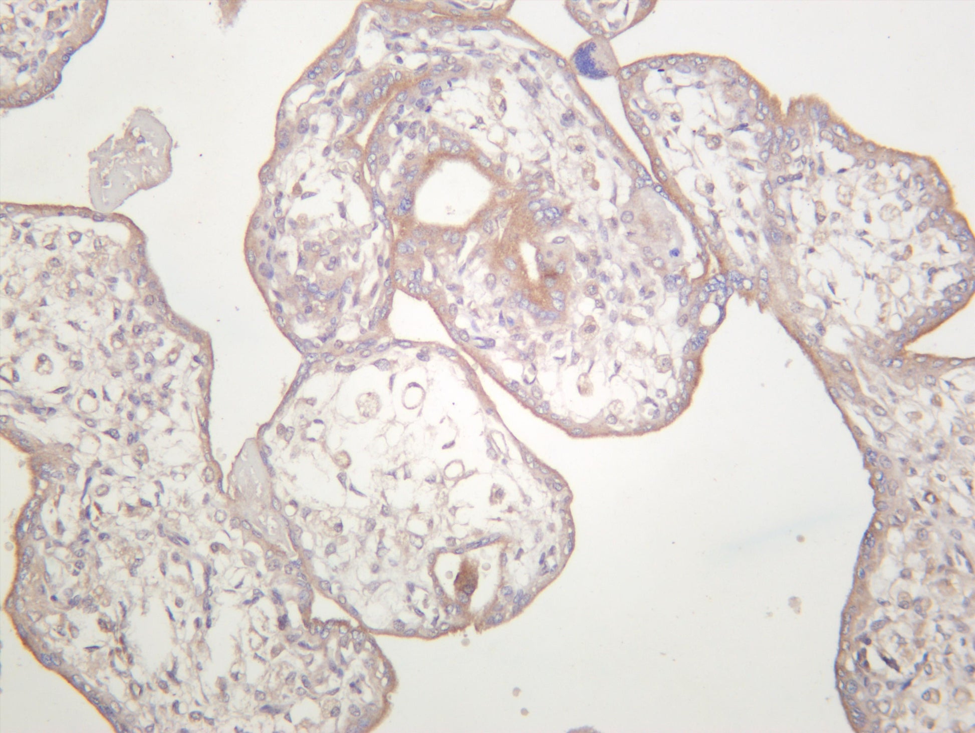 Human placenta was stained with anti-TGF Î² Receptor II (PT0368R) rabbit antibody