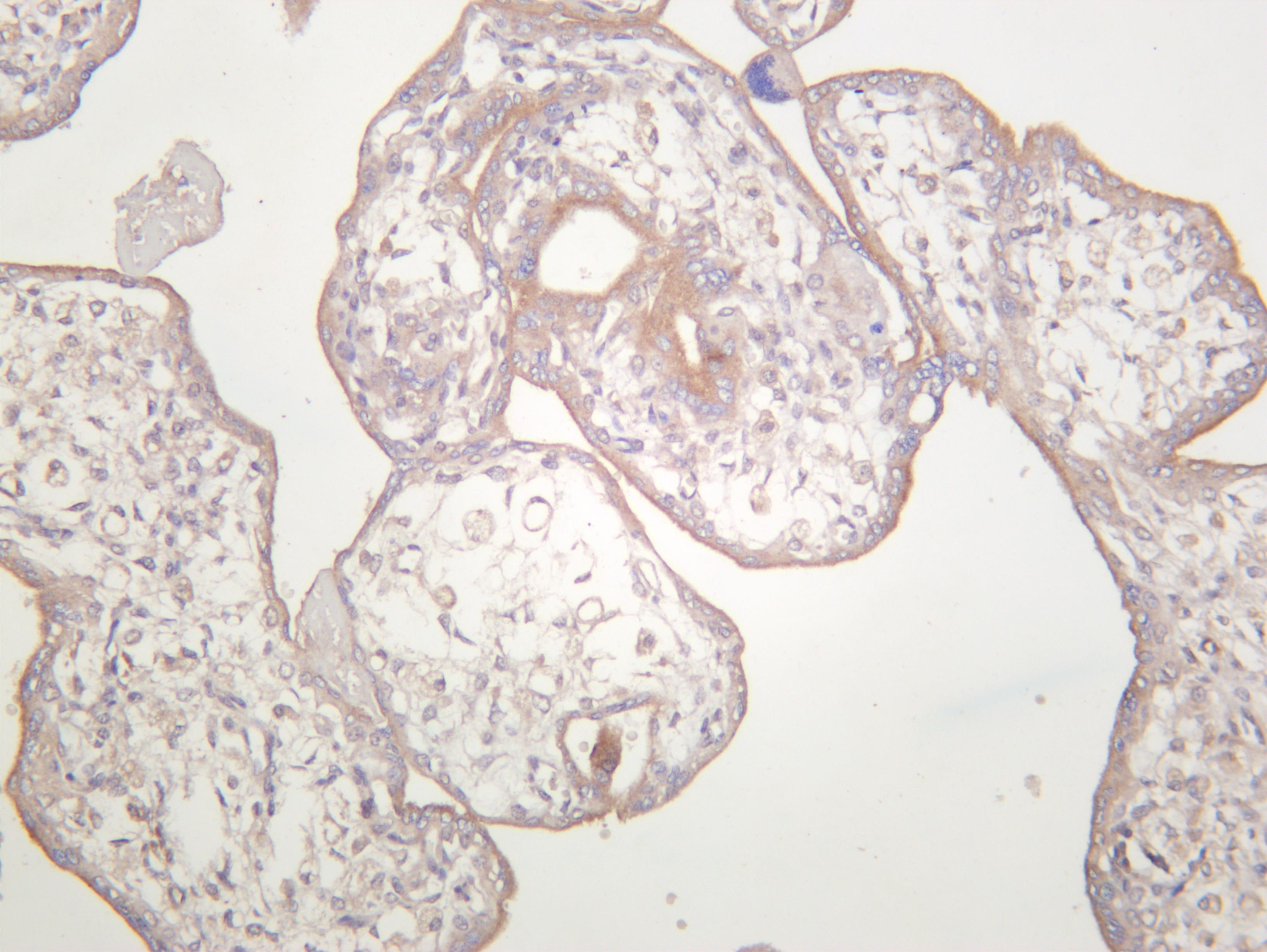 Human placenta was stained with anti-TGF Î² Receptor II (PT0368R) rabbit antibody