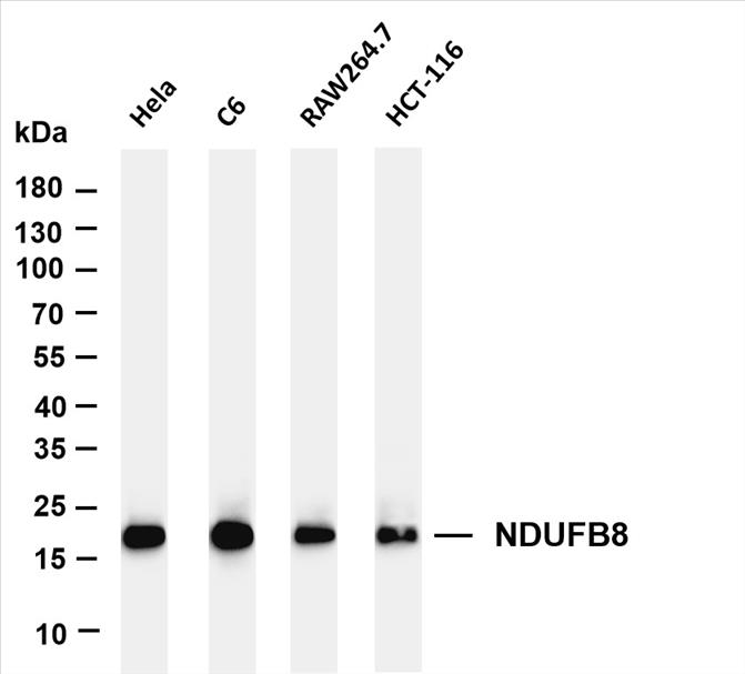 Various whole cell lysates were separated by 4-20% SDS-PAGE, and the membrane was blotted with anti-NDUFB8 (PT0369R) antibody. The HRP-conjugated Goat anti-Rabbit IgG(H + L) antibody was used to detect the antibody.
