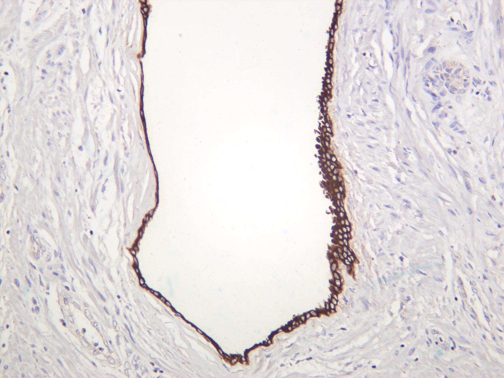 Human prostate was stained with anti-Cytokeratin 7 (PT0375R) rabbit antibody
