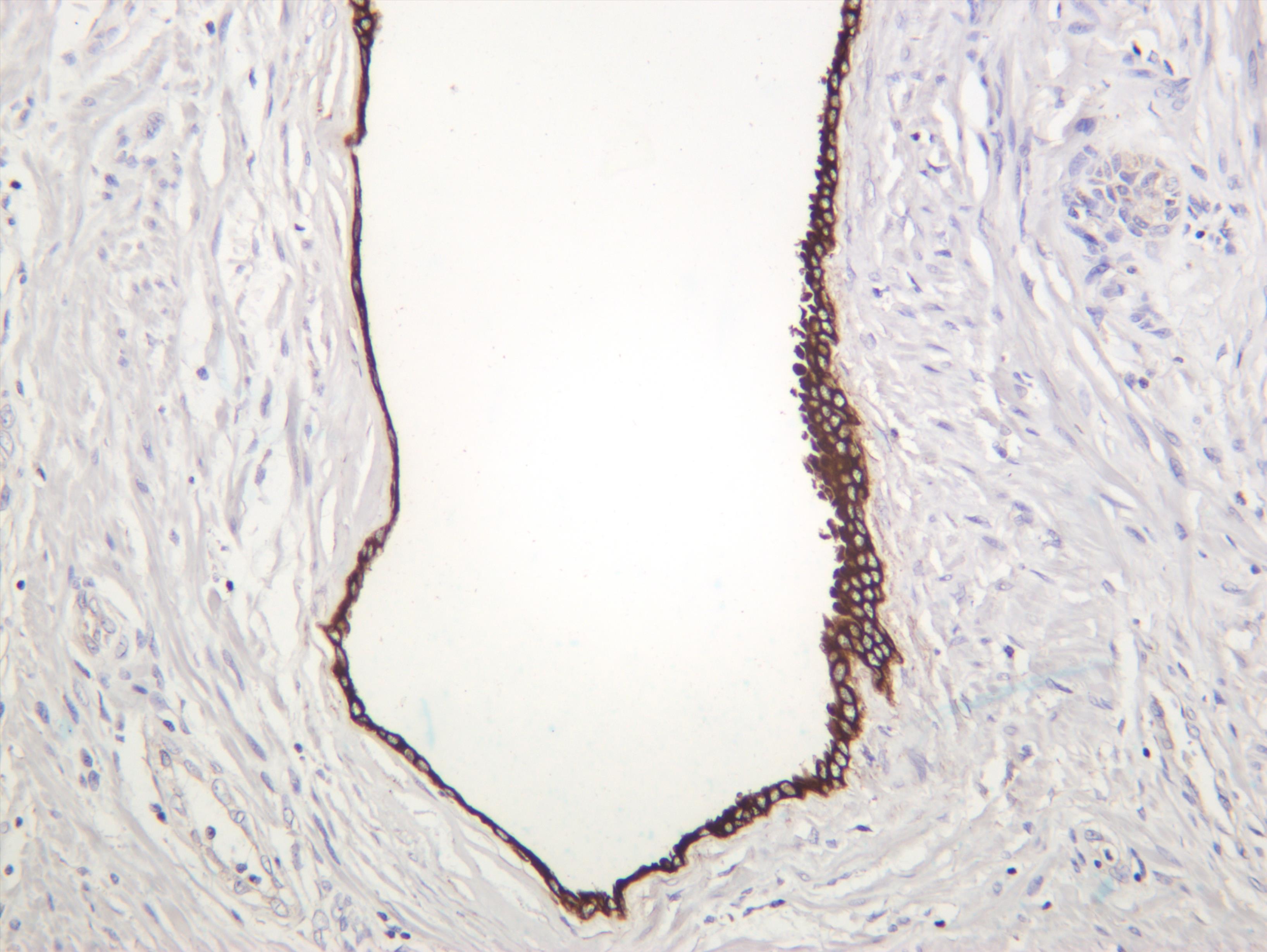 Human prostate was stained with anti-Cytokeratin 7 (PT0375R) rabbit antibody