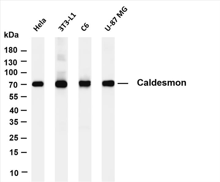 Various whole cell lysates were separated by 4-20% SDS-PAGE, and the membrane was blotted with anti-Caldesmon (PT0379R) antibody. The HRP-conjugated Goat anti-Rabbit IgG(H + L) antibody was used to detect the antibody.