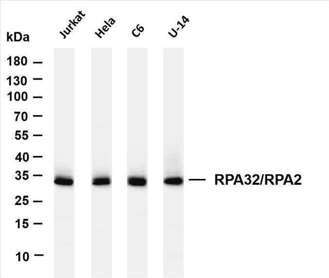Various whole cell lysates were separated by 4-20% SDS-PAGE, and the membrane was blotted with anti-RPA32/RPA2 (PT0380R) antibody. The HRP-conjugated Goat anti-Rabbit IgG(H + L) antibody was used to detect the antibody.