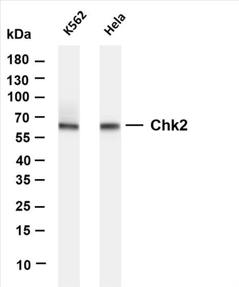 Various whole cell lysates were separated by 4-20% SDS-PAGE, and the membrane was blotted with anti-Chk2 (PT0381R) antibody. The HRP-conjugated Goat anti-Rabbit IgG(H + L) antibody was used to detect the antibody.