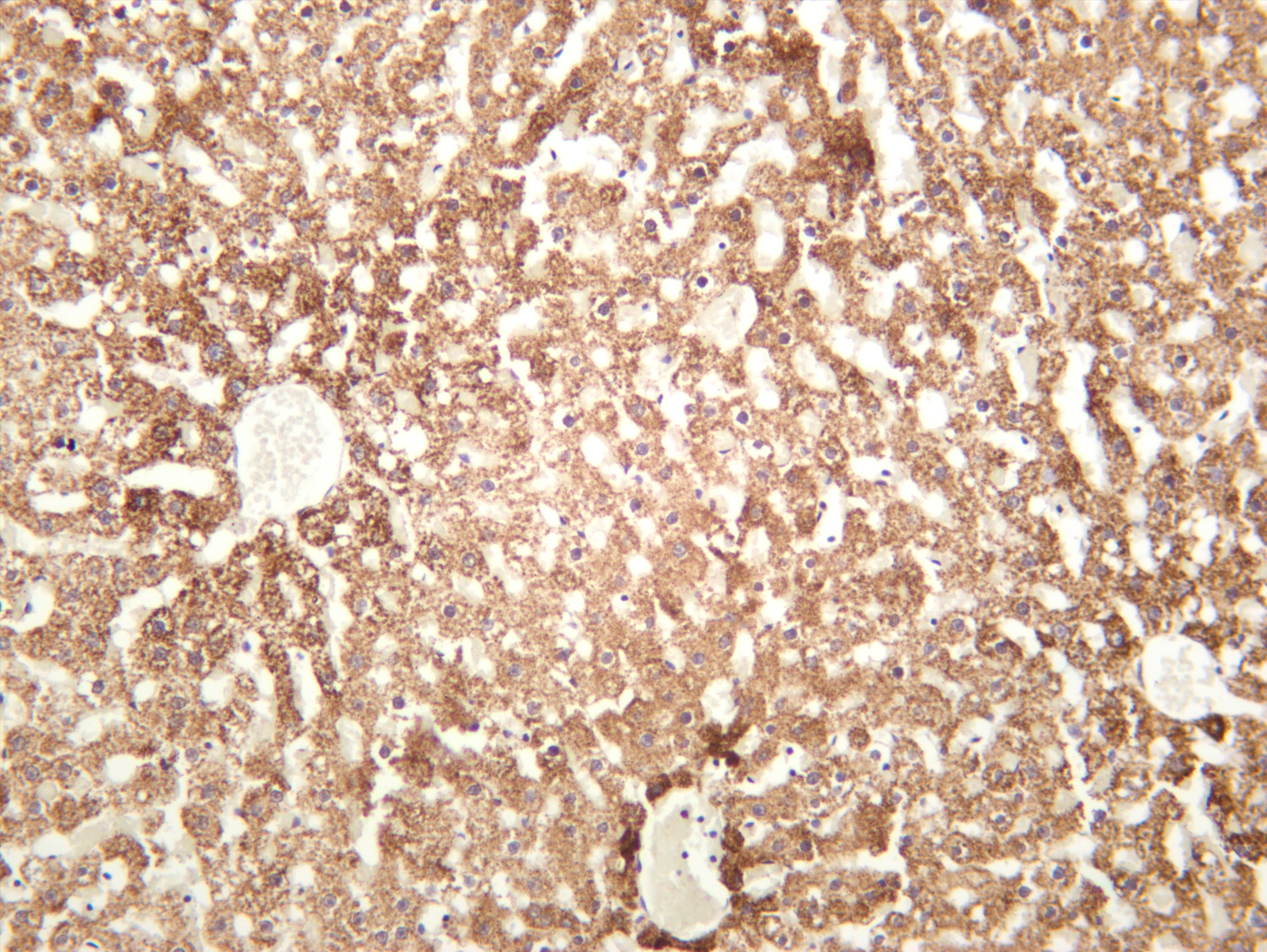 Rat liver was stained with anti-PPARÎ± (PT0384R) rabbit antibody