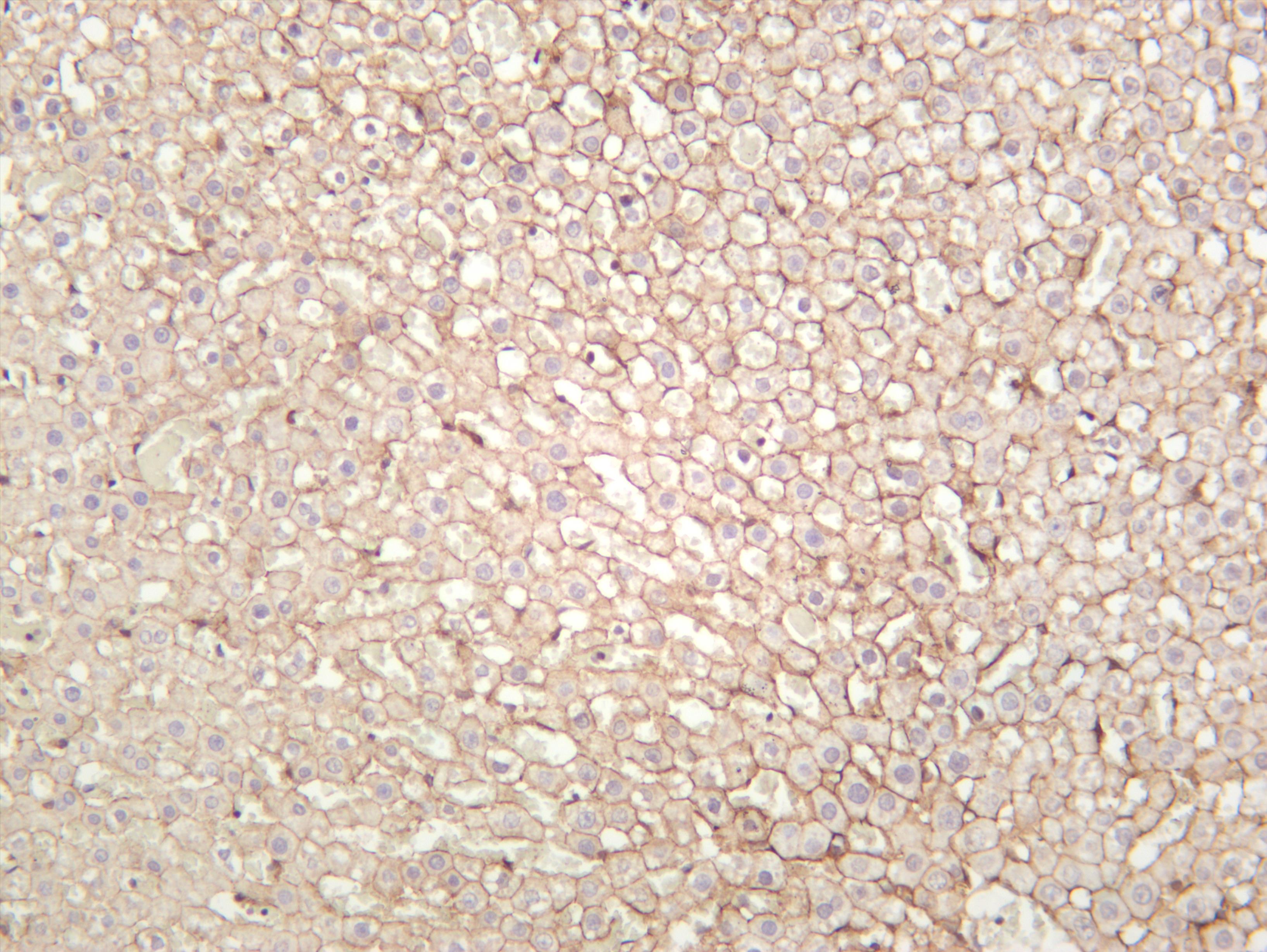 Rat liver was stained with anti-Catenin Î´-1 (PT0385R) rabbit antibody