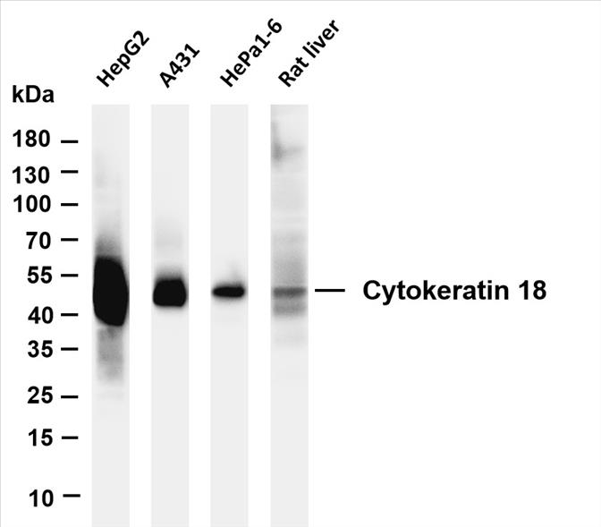 Various whole cell lysates were separated by 4-20% SDS-PAGE, and the membrane was blotted with anti-Cytokeratin 18 (PT0395R) antibody. The HRP-conjugated Goat anti-Rabbit IgG(H + L) antibody was used to detect the antibody.