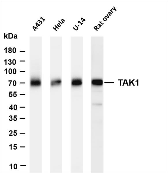 Various whole cell lysates were separated by 4-20% SDS-PAGE, and the membrane was blotted with anti-TAK1 (PT0396R) antibody. The HRP-conjugated Goat anti-Rabbit IgG(H + L) antibody was used to detect the antibody.
