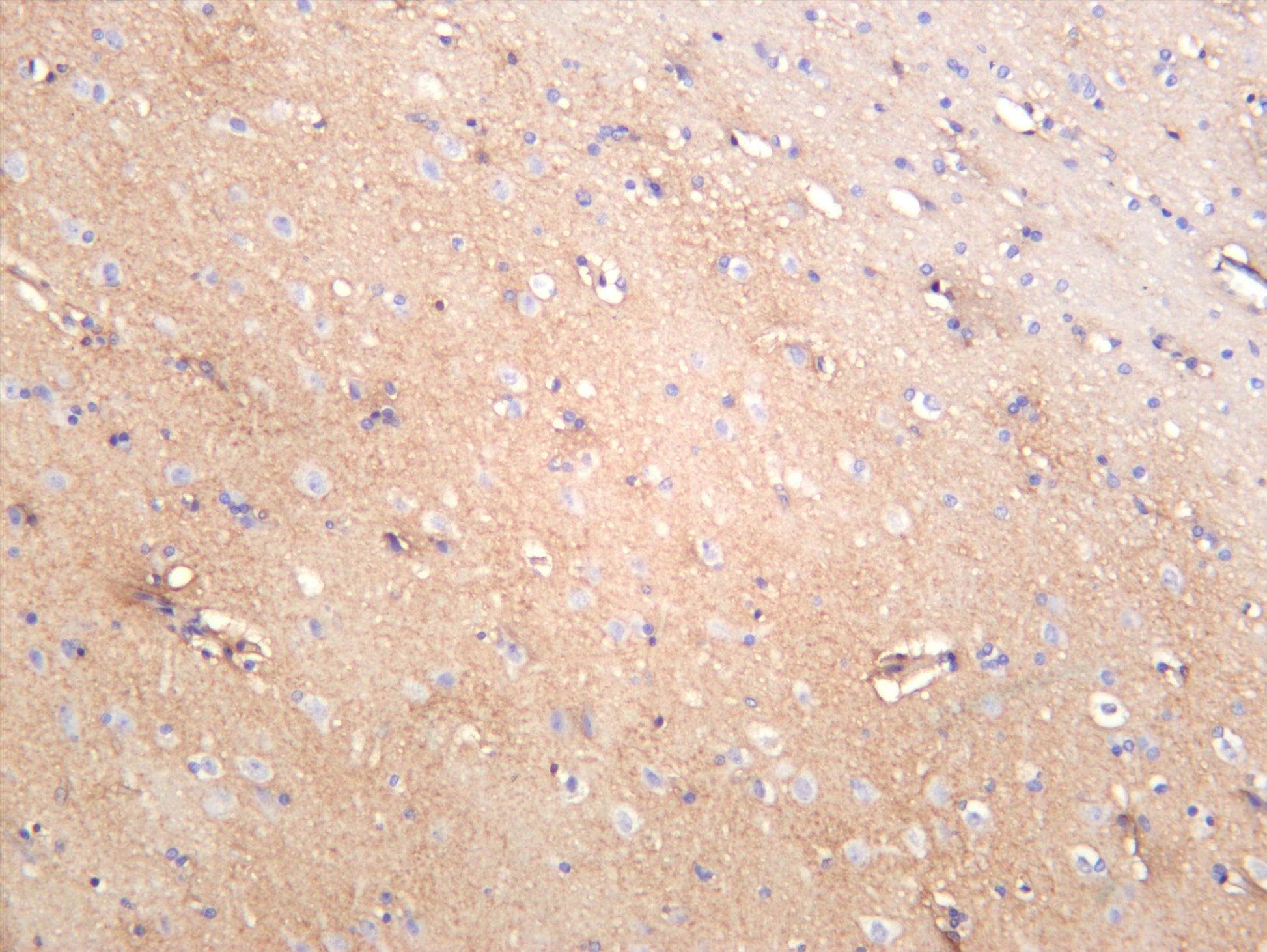 Human brain was stained with anti-xCT (PT0398R) rabbit antibody