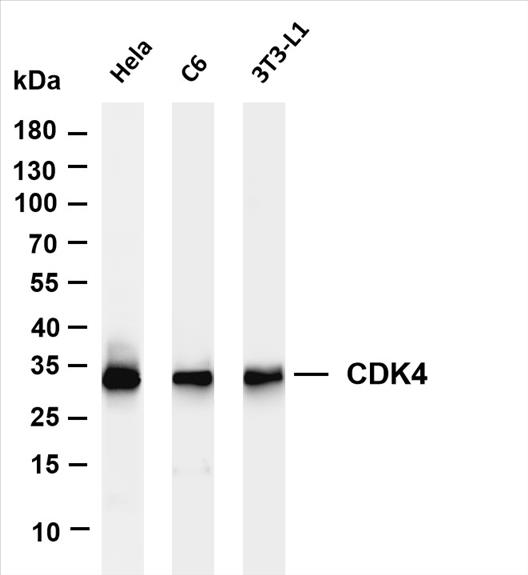 Various whole cell lysates were separated by 4-20% SDS-PAGE, and the membrane was blotted with anti-CDK4 (PT0399R) antibody. The HRP-conjugated Goat anti-Rabbit IgG(H + L) antibody was used to detect the antibody.