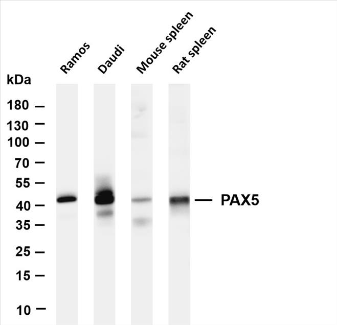 Various whole cell lysates were separated by 4-20% SDS-PAGE, and the membrane was blotted with anti-PAX5 (PT0400R) antibody. The HRP-conjugated Goat anti-Rabbit IgG(H + L) antibody was used to detect the antibody.