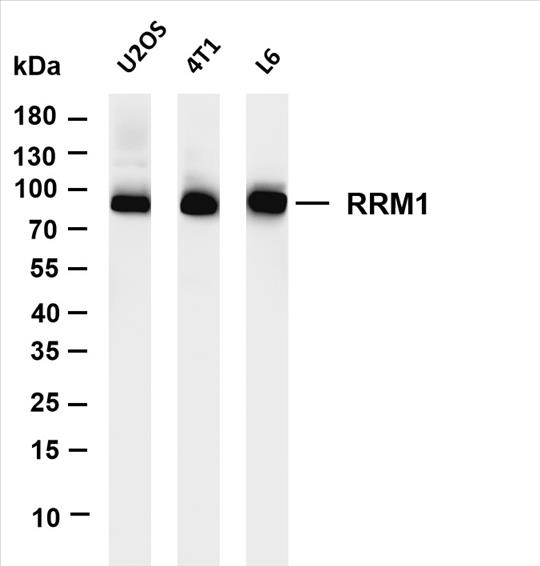 Various whole cell lysates were separated by 4-20% SDS-PAGE, and the membrane was blotted with anti-RRM1 (PT0410R) antibody. The HRP-conjugated Goat anti-Rabbit IgG (H + L) antibody was used to detect the antibody.