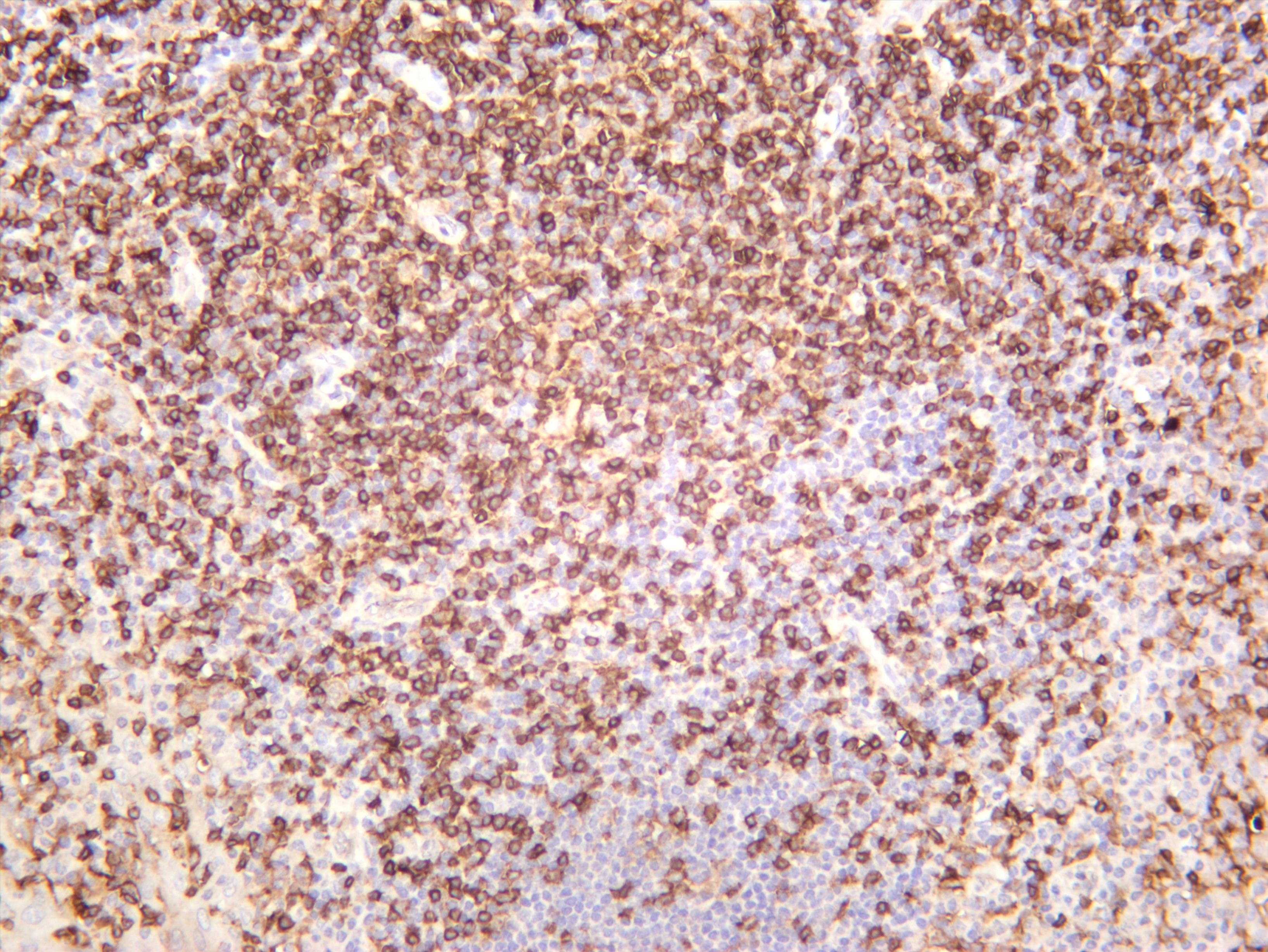 Human tonsil was stained with anti-CD4 (PT0412R) rabbit antibody