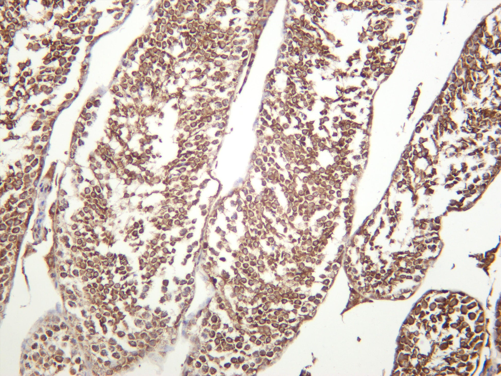 Mouse testis was stained with anti-GSK3 Î±/Î² (PT0413R) rabbit antibody