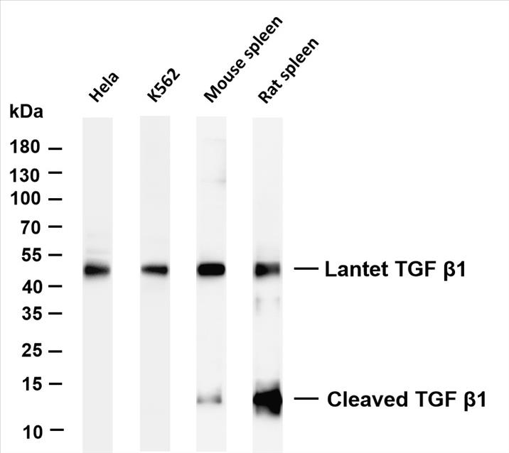 Various whole cell lysates were separated by 4-20% SDS-PAGE, and the membrane was blotted with anti-TGF Î²1 (PT0415R) antibody. The HRP-conjugated Goat anti-Rabbit IgG(H + L) antibody was used to detect the antibody.