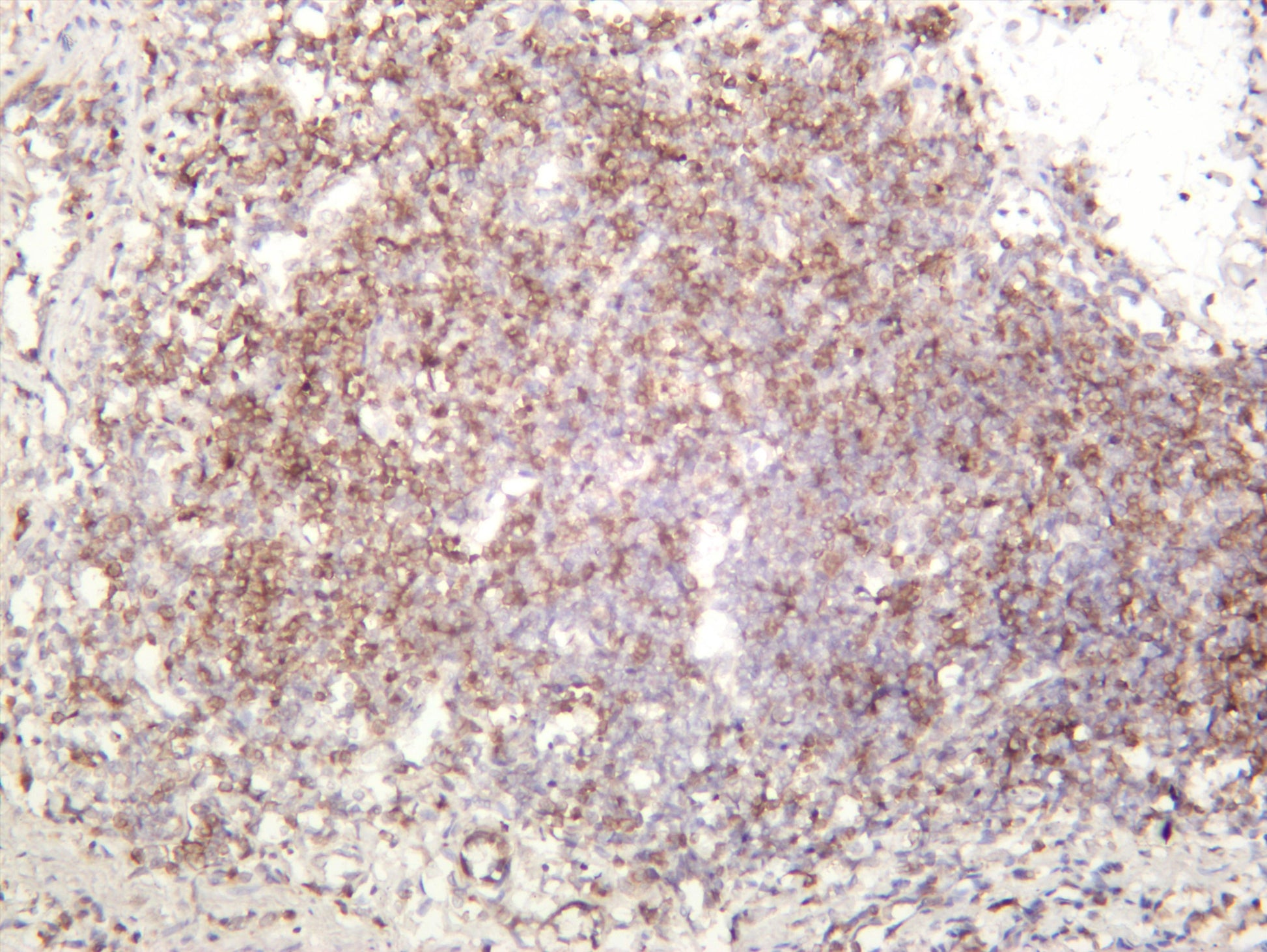 Rat colon was stained with anti-Lck (PT0416R) rabbit antibody