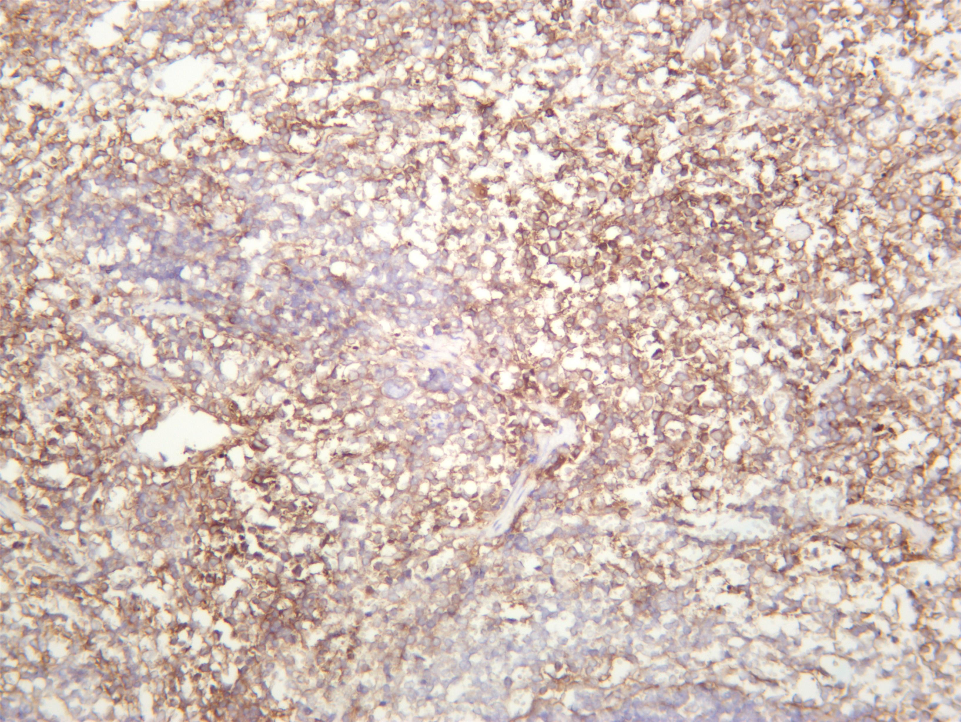 Mouse spleen was stained with anti-CD14 (PT0417R) rabbit antibody