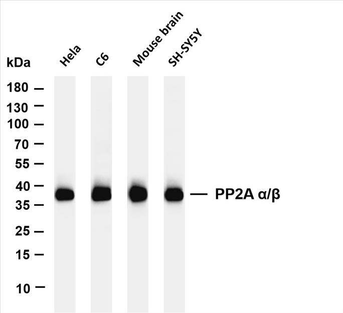 Various whole cell lysates were separated by 4-20% SDS-PAGE, and the membrane was blotted with anti- PP2A Î±/Î² (PT0421R) antibody. The HRP-conjugated Goat anti-Rabbit IgG(H + L) antibody was used to detect the antibody.