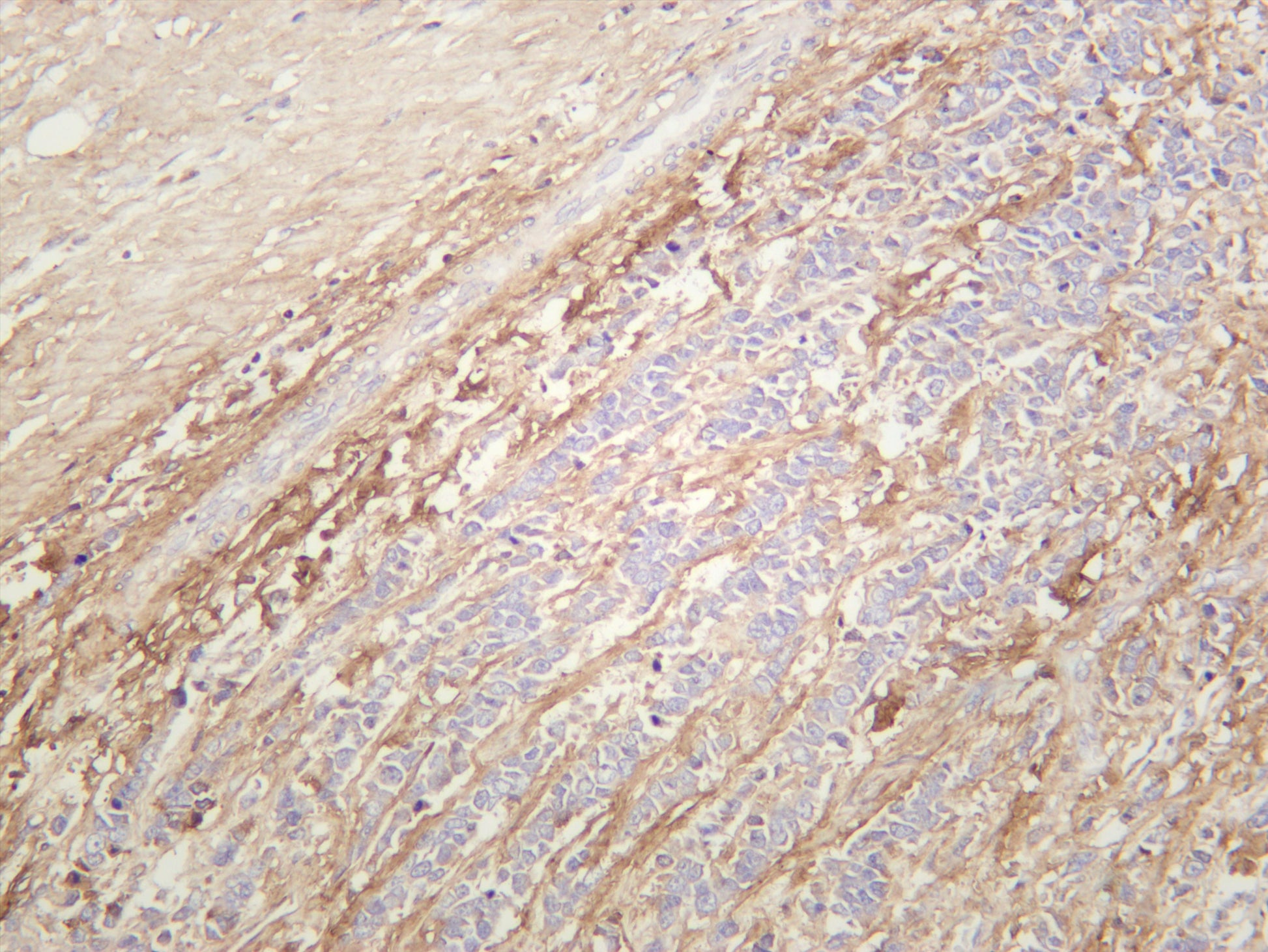 Human breast was stained with anti-Periostin (PT0423R) rabbit antibody