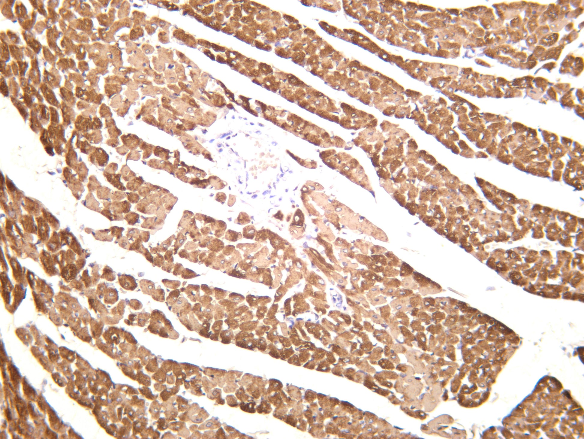 Rat cardiac muscle was stained with anti-MYL2 (PT0425R) rabbit antibody