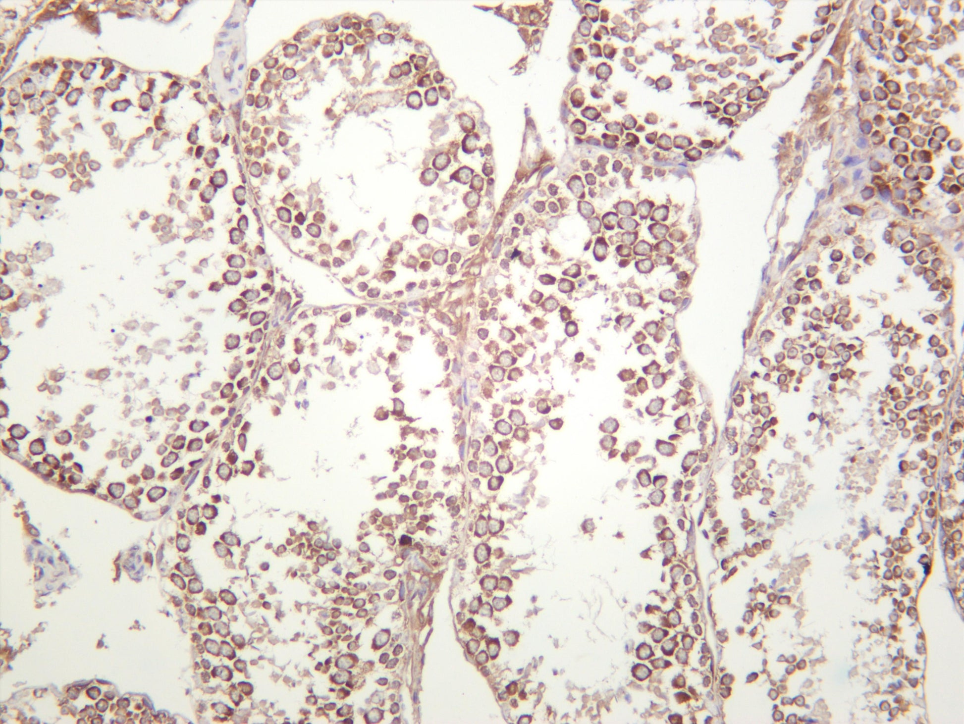 Mouse testis was stained with anti-YTHDF2 (PT0426R) rabbit antibody