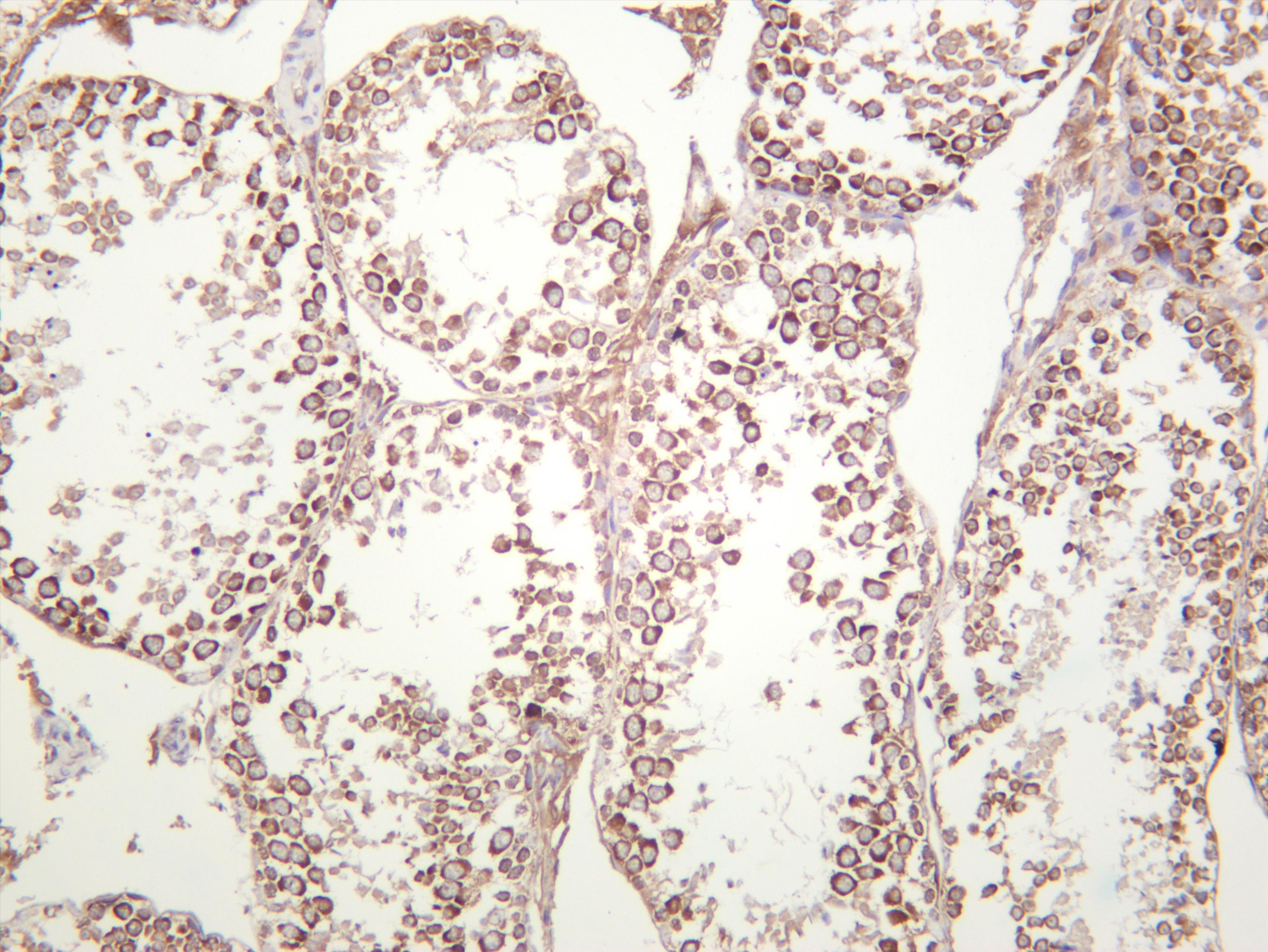 Mouse testis was stained with anti-YTHDF2 (PT0426R) rabbit antibody