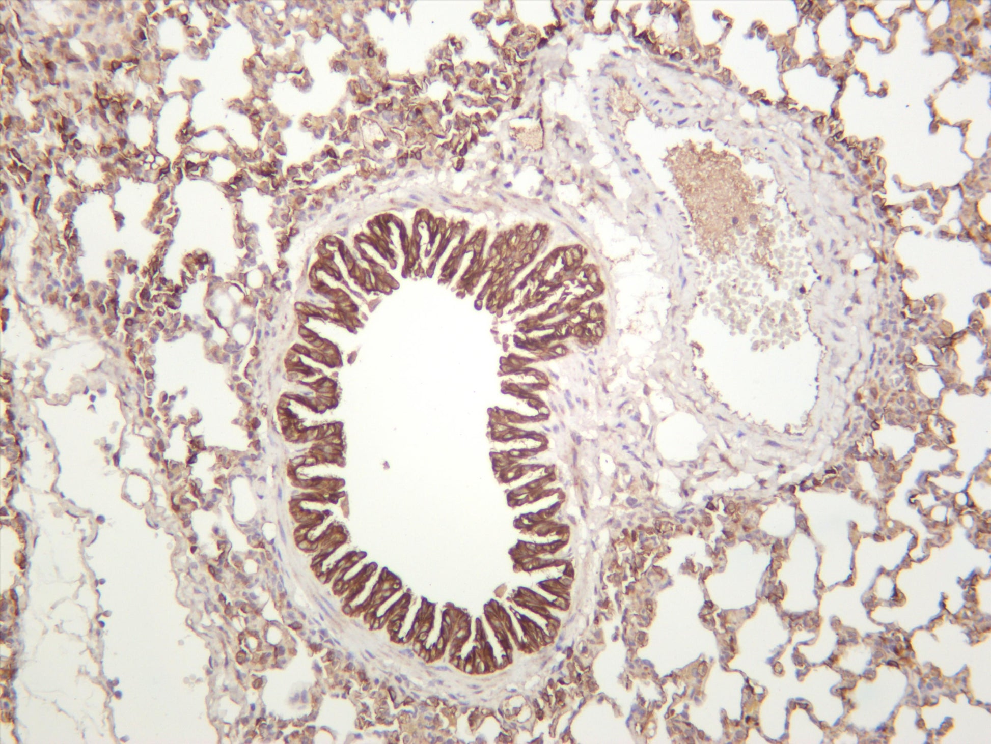 Mouse lung was stained with anti-Cytokeratin 19 (PT0427R) rabbit antibody