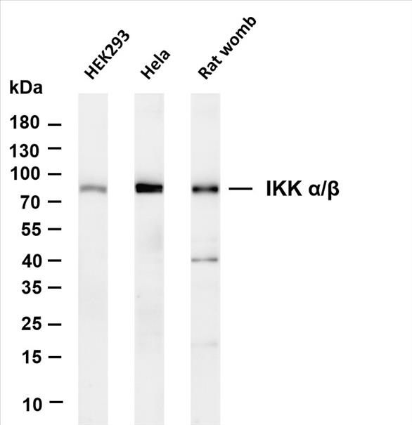 Various whole cell lysates were separated by 4-20% SDS-PAGE, and the membrane was blotted with anti-IKK Î±/Î² (PT0435R) antibody. The HRP-conjugated Goat anti-Rabbit IgG(H + L) antibody was used to detect the antibody.
