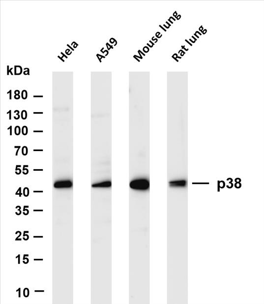 Various whole cell lysates were separated by 4-20% SDS-PAGE, and the membrane was blotted with anti-p38 (PT0436R) antibody. The HRP-conjugated Goat anti-Rabbit IgG(H + L) antibody was used to detect the antibody.