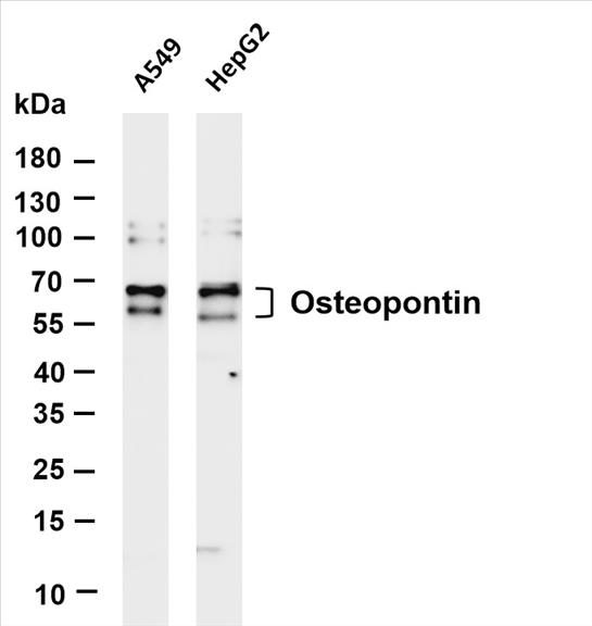 Various whole cell lysates were separated by 4-20% SDS-PAGE, and the membrane was blotted with anti-Osteopontin (PT0442R) antibody. The HRP-conjugated Goat anti-Rabbit IgG(H + L) antibody was used to detect the antibody.
