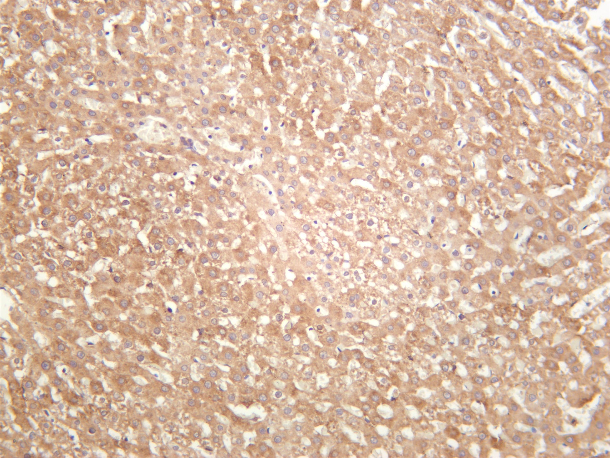 Rat liver was stained with anti-ACSL4 (PT0448R) rabbit antibody