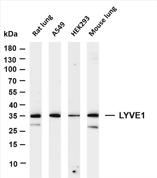 Various whole cell lysates were separated by 4-20% SDS-PAGE, and the membrane was blotted with anti-LYVE1 (PT0449R) antibody. The HRP-conjugated Goat anti-Rabbit IgG(H + L) antibody was used to detect the antibody.