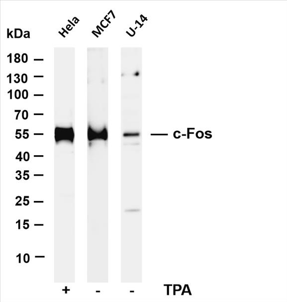 Various whole cell lysates were separated by 4-20% SDS-PAGE, and the membrane was blotted with anti-c-Fos (PT0451R) antibody. The HRP-conjugated Goat anti-Rabbit IgG(H + L) antibody was used to detect the antibody.